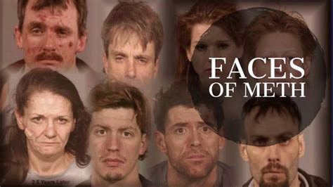 facial abuse images|PHOTOS: How methamphetamine destroys your face and .